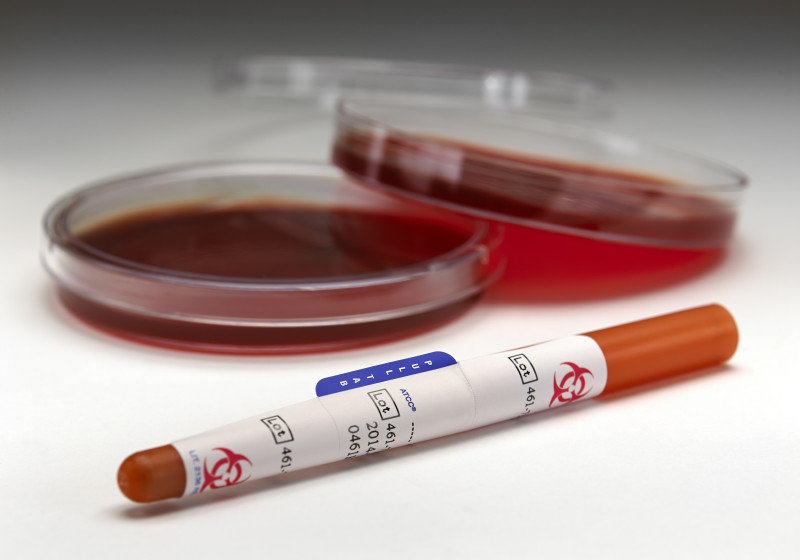 Bild von Microbiologics Inc.und LabRaum sind Partner